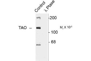 Image no. 1 for anti-TAO Kinase 2 (TAOK2) (pSer181) antibody (ABIN361519)