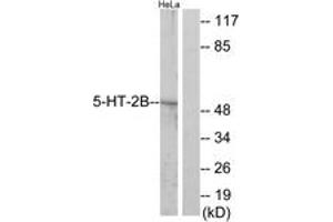 Image no. 3 for anti-Serotonin Receptor 2B (HTR2B) (AA 261-310) antibody (ABIN1534243)