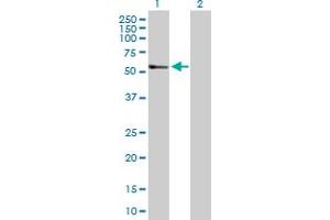 Image no. 1 for anti-Transforming Growth Factor, beta 2 (TGFB2) (AA 1-414) antibody (ABIN520874)
