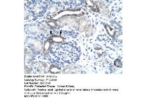 Image no. 2 for anti-EVX1 (EVX1) (N-Term) antibody (ABIN2792604)