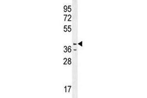 Image no. 7 for anti-Caspase 12 (Gene/pseudogene) (CASP12) (AA 165-193) antibody (ABIN3030291)