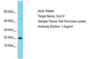 Image no. 1 for anti-Sorting Nexin 12 (SNX12) (AA 86-135) antibody (ABIN6750493)