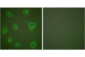 Image no. 2 for anti-Collagen, Type II (COL2) (N-Term) antibody (ABIN1848474)