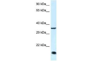 Image no. 1 for anti-Kruppel-Like Factor 3 (Basic) (KLF3) (C-Term) antibody (ABIN927782)