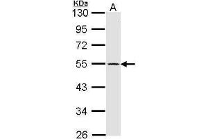 WB Image Sample (30 ug of whole cell lysate) A: IMR32 10% SDS PAGE antibody diluted at 1:1000