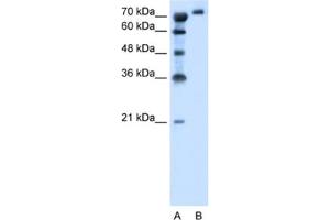 Image no. 1 for anti-Solute Carrier Family 6, Member 18 (SLC6A18) antibody (ABIN2462786)