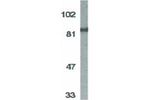 Image no. 2 for anti-conserved Helix-Loop-Helix Ubiquitous Kinase (CHUK) (C-Term) antibody (ABIN6655527)