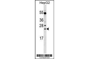 Image no. 1 for anti-Leucine Rich Repeat Containing 29 (LRRC29) (AA 32-60), (N-Term) antibody (ABIN1539296)