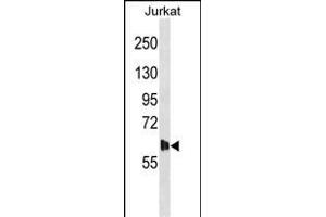 DK Antibody (N-term) (ABIN1538919 and ABIN2848685) western blot analysis in Jurkat cell line lysates (35 μg/lane).