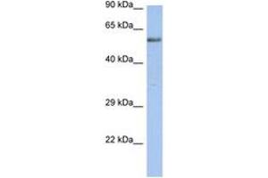 ZNF513 anticorps  (AA 71-120)