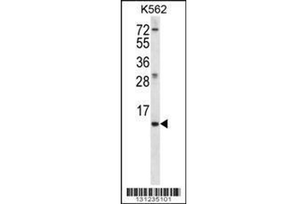 anti-Meiosis Expressed Gene 1 Homolog (MEIG1) (AA 36-65) antibody