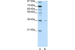 Image no. 1 for anti-Forkhead Box Q1 (FOXQ1) (N-Term) antibody (ABIN2778428)