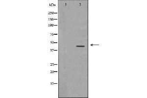 Image no. 1 for anti-Cyclin-Dependent Kinase 9 (CDK9) antibody (ABIN6260723)