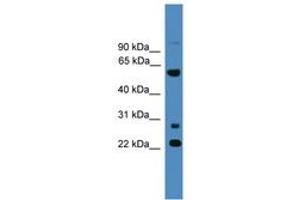 Image no. 1 for anti-Meiosis-Specific Nuclear Structural 1 (MNS1) (AA 91-140) antibody (ABIN6746497)