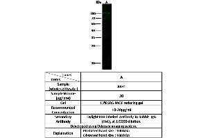 Image no. 1 for anti-ADAM Metallopeptidase Domain 12 (ADAM12) (AA 1-513) antibody (ABIN2681510)