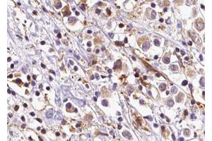 Image no. 2 for anti-Ovarian Cancer Overexpressed 1 (OVCOV1) (C-Term) antibody (ABIN6259278)