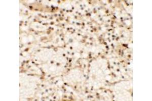 Immunohistochemistry of CLEC7A in human spleen tissue with CLEC7A antibody at 5 µg/ml.