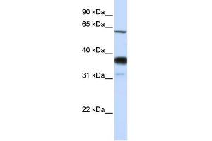 Image no. 1 for anti-Sphingomyelin Phosphodiesterase 3 (SMPD3) (Middle Region) antibody (ABIN2783713)