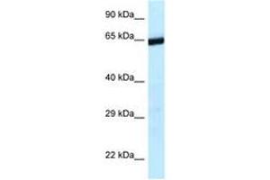 Image no. 1 for anti-Excision Repair Cross-Complementing Rodent Repair Deficiency, Complementation Group 6-Like 2 (ERCC6L2) (AA 1120-1169) antibody (ABIN6747427)
