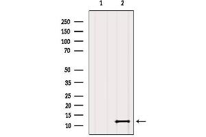 Western blot analysis of extracts from Mouse brain, using SH3BGRL2 Antibody.