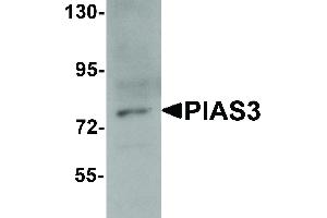 Image no. 1 for anti-Protein Inhibitor of Activated STAT, 3 (PIAS3) (C-Term) antibody (ABIN6656302)