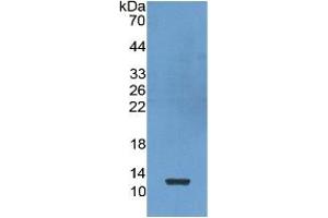 Image no. 2 for Pro-Platelet Basic Protein (Chemokine (C-X-C Motif) Ligand 7) (PPBP) ELISA Kit (ABIN6574153)