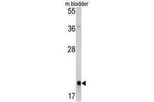 Image no. 1 for anti-RAB13, Member RAS Oncogene Family (RAB13) (Middle Region) antibody (ABIN453324)