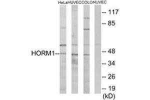 Image no. 1 for anti-HORMA Domain Containing 1 (HORMAD1) (AA 321-370) antibody (ABIN1533982)