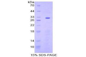 Image no. 1 for Ectonucleoside Triphosphate diphosphohydrolase 1 (ENTPD1) (AA 98-352) protein (His tag) (ABIN1879470)