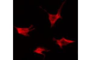 Image no. 2 for anti-Activin A Receptor Type II-Like 1 (ACVRL1) antibody (ABIN6256992)