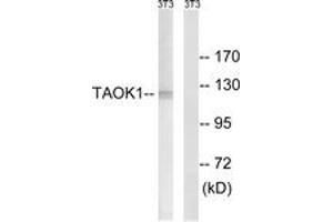 Image no. 1 for anti-TAO Kinase 1 (TAOK1) (AA 431-480) antibody (ABIN1535345)