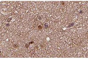 Image no. 1 for anti-Synaptosomal-Associated Protein, 25kDa (SNAP25) (C-Term) antibody (ABIN6265203)