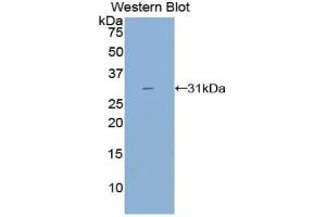 CYP21A2 antibody  (AA 37-264)