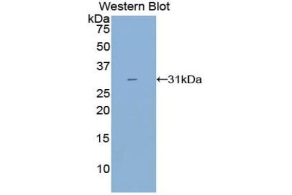 CYP21A2 anticorps  (AA 37-264)