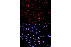 Image no. 3 for anti-Structural Maintenance of Chromosomes 1A (SMC1A) (pSer957) antibody (ABIN3019554)