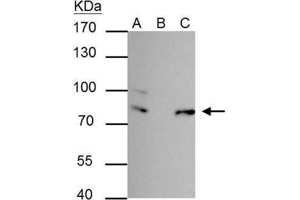FUBP1 antibody  (Center)