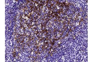 Image no. 3 for anti-Fc Fragment of IgE, Low Affinity II, Receptor For (CD23) (FCER2) (AA 48-321) antibody (ABIN2649195)