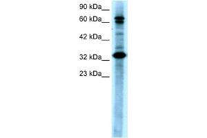 Image no. 2 for anti-TGF-beta Activated Kinase 1/MAP3K7 Binding Protein 2 (TAB2) (N-Term) antibody (ABIN2779619)