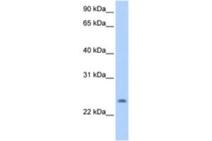 Image no. 1 for anti-PQ Loop Repeat Containing 1 (PQLC1) antibody (ABIN2463302)