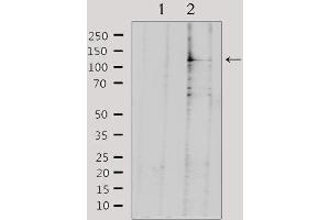 Image no. 4 for anti-serologically Defined Colon Cancer Antigen 1 (SDCCAG1) (C-Term) antibody (ABIN6259616)