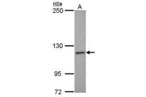 Image no. 2 for anti-NCK Associated Protein 1 (NCKAP1) (N-Term) antibody (ABIN1494055)
