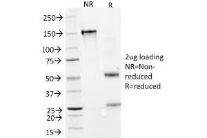 Image no. 1 for anti-Interferon, alpha 2 (IFNA2) antibody (ABIN6939691)