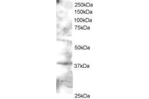 Image no. 2 for anti-GRB2-Related Adaptor Protein 2 (GRAP2) (C-Term) antibody (ABIN184603)