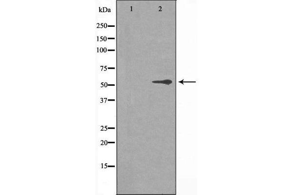 anti-Cytochrome P450, Family 2, Subfamily R, Polypeptide 1 (CYP2R1) (Internal Region) antibody