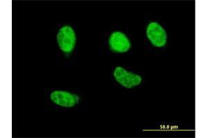 Image no. 4 for anti-Nuclear Factor (erythroid-Derived 2)-Like 2 (NFE2L2) (AA 71-170) antibody (ABIN561975)