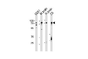 Image no. 1 for anti-Far Upstream Element (FUSE) Binding Protein 1 (FUBP1) (AA 240-268) antibody (ABIN5534289)