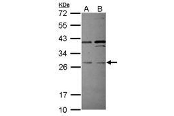 PLEKHF2 antibody  (AA 60-249)