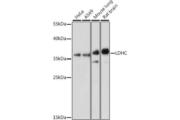 Lactate Dehydrogenase C anticorps  (AA 150-250)