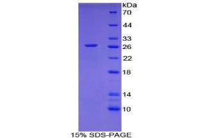 Image no. 1 for CD302 (CD302) (AA 21-225) protein (His tag) (ABIN1879496)