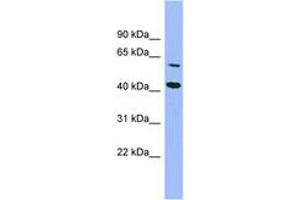 Image no. 1 for anti-Glucose-Fructose Oxidoreductase Domain Containing 1 (GFOD1) (AA 287-336) antibody (ABIN6744164)